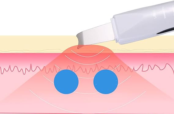 Face Blackhead Remover Tool for Deep Cleansing and Skin Rejuvenation