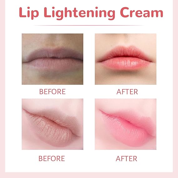 Lips Bleaching Cream Balm for Even Skin Tone and Brightening