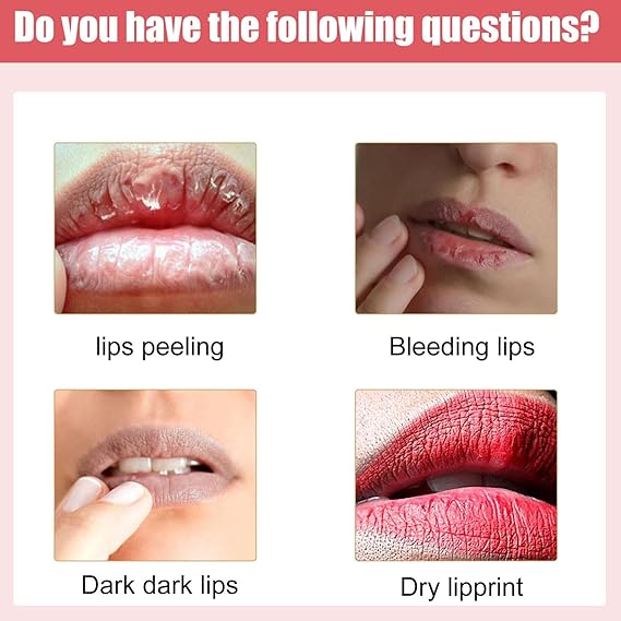 Lips Bleaching Cream Balm for Even Skin Tone and Brightening