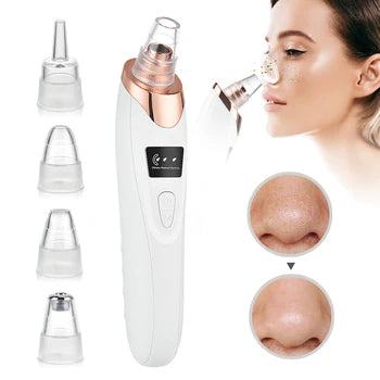 Pore Vacuum Blackhead Remover – Deep Cleansing Tool