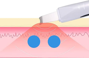 Face Blackhead Remover Tool for Deep Cleansing and Skin Rejuvenation