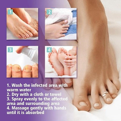 Nail Fungus Treatment Spray – Powerful Solution for Healthy Hands & Feet