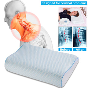 Orthopedic Memory Foam Pillow for Ultimate Comfort and Medical Support